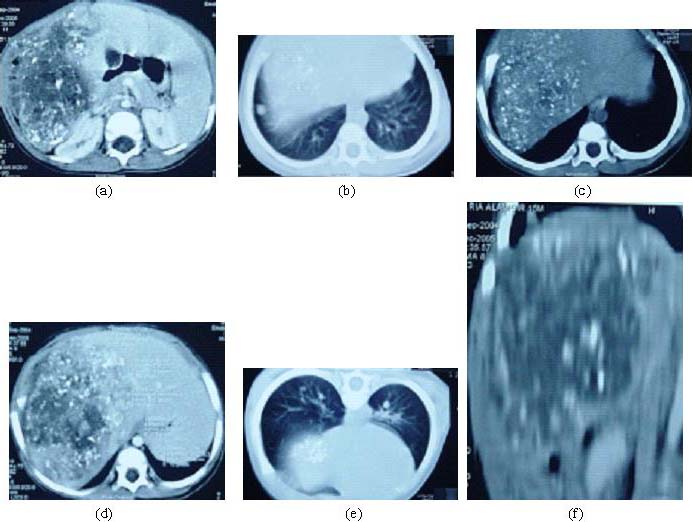 penis lung 22cm